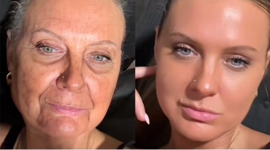 Before and after skin transformation